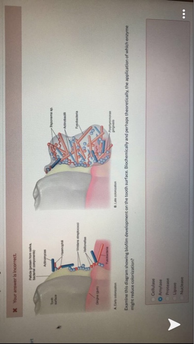 X Your answer is incorrect. Polide protein from a becer components Acta -Vindas streptococo Fusobacteria Porphy ging Examine