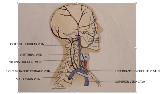 EXTERNAL JUGULAR VEIN VERTEBRAL VEIN INTERNAL JUGULAR VEIN RIGHT BRANCHIO CEPHALIC VEIN LEFT BRANCHIO CHEPHALIC VEIN SUBCLAVI