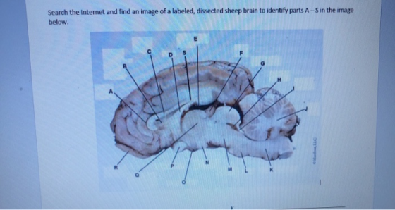 Search the Internet and find an image of a labeled, dissected sheep brain to identify parts A-S in the image below.