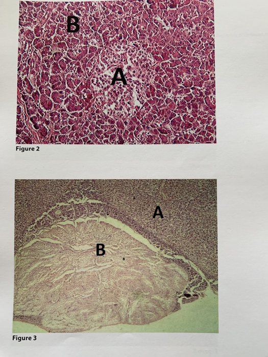 Figure 2 Figure 3