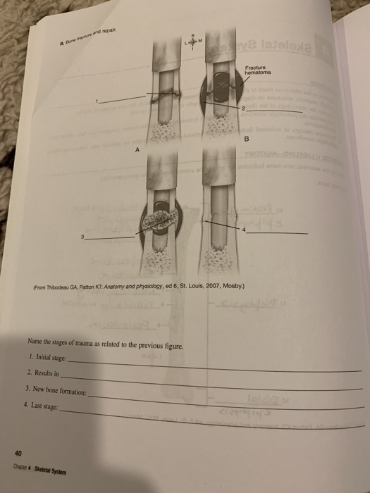 sielole From Thibodeau GA, Patton KT: Anatomy and physiology, ed 6, St. Louis, 2007, Mosby.) Name the stages of trauma as rel