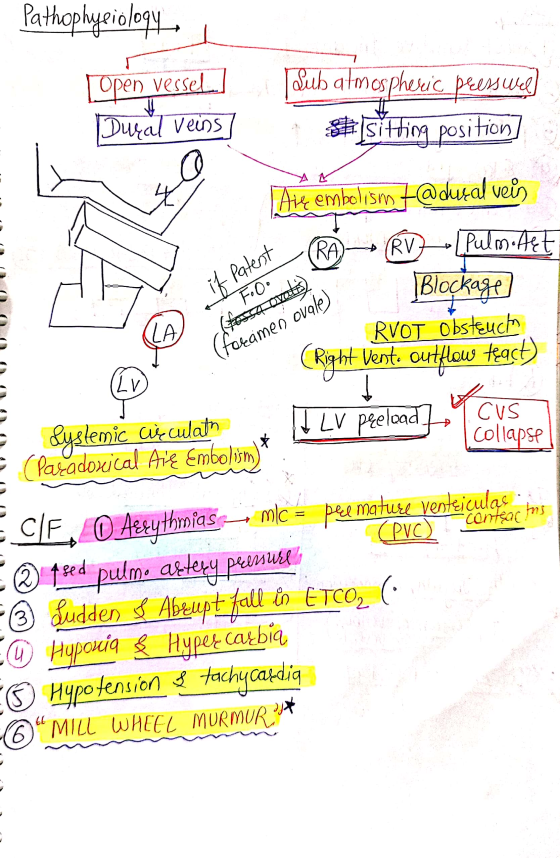 Pathophysiology Lopen vessel] Dusal veins ] Sub atmospheric presswel #sitting position) - Ave embolism t@duzal veis pantent R