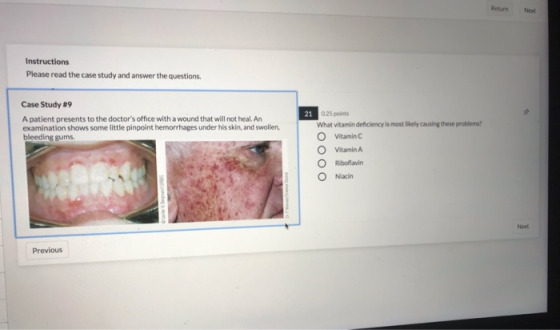 Instructions Please read the case study and answer the questions. Case Study #9 A patient presents to the doctors office wit