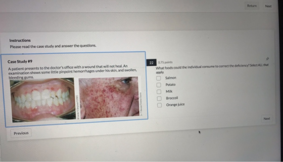 Return Next Instructions Please read the case study and answer the questions. Case Study #9 A patient presents to the doctor