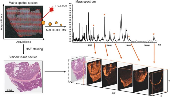 Matrix spotted section Mass spectrum UV-Laser Acquisition y MALDI-TOF MS Acquisition x 5000 10000 15000 20000 m/z H&E stainin