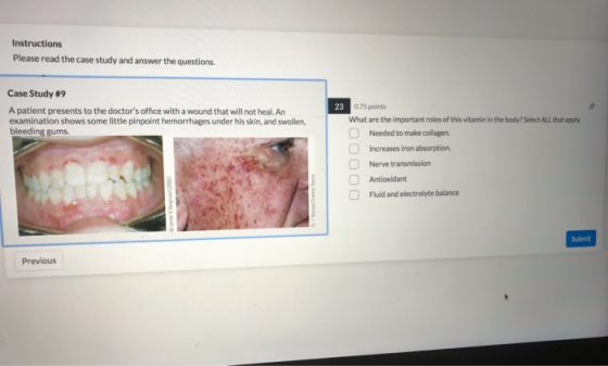 Instructions Please read the case study and answer the questions Case Study #9 A patient presents to the doctors office with