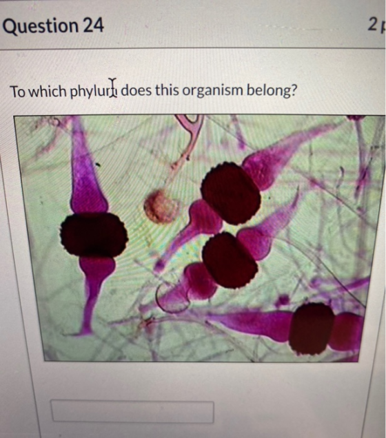 Question 24 21 To which phylurte does this organism belong?