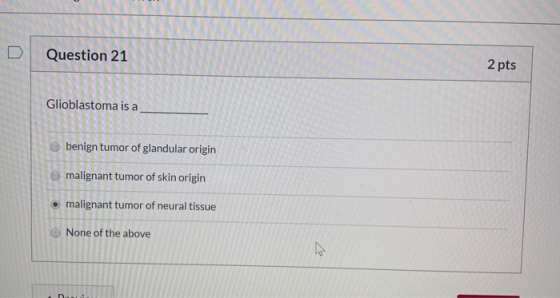 D Question 21 2 pts Glioblastoma is a benign tumor of glandular origin malignant tumor of skin origin malignant tumor of neur