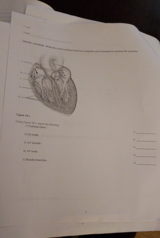 Name SHORT ANSWER. Write the word that r phrase that hest completes ach statement or anwers the question Figure 18.1 1) Using Fiqure 18.1, match the follonwing 1) Purkinje fibers 2) SA node. 3) AV bundle 4) 4) AV node. 5) 5) Bundle branches