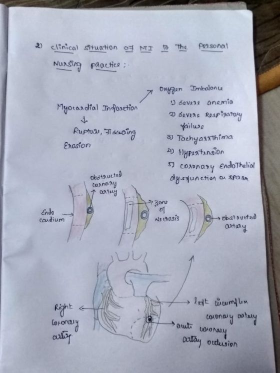 D personal clinical situation of MI to the Nursing practice 7 Myocardial Infarction Ruptur, Fisswing Erosion Onygen Imbalonce