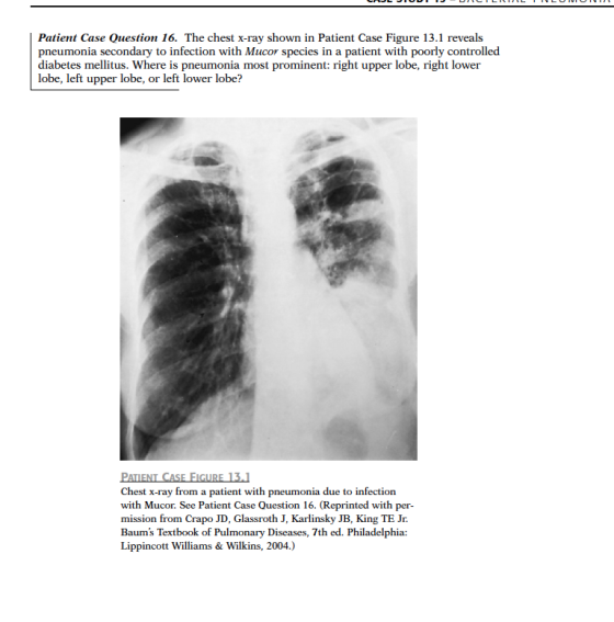 Patient Case Question 16. The chest x-ray shown in Patient Case Figure 13.1 reveals pneumonia secondary to infection with Muc