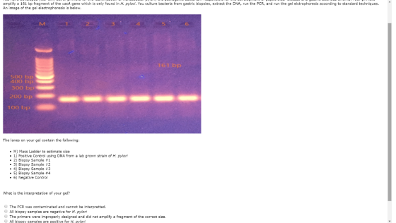 amplify a 161 bp fragment of the vaca gene which is only found in H. pylori. You culture bacteria from gastric biopsies, extr