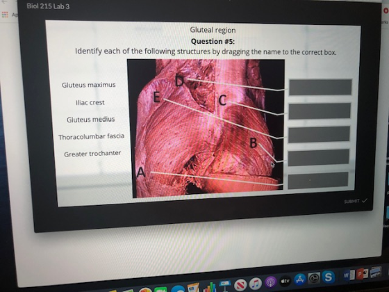 Biol 215 Lab 3 AE Gluteal region Question #5: Identify each of the following structures by dragging the name to the correct b
