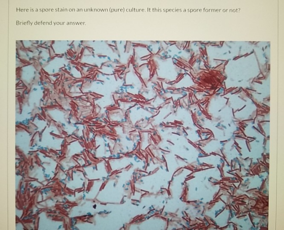 Here is a spore stain on an unknown (pure) culture. It this species a spore former or not? Briefly defend your answer.