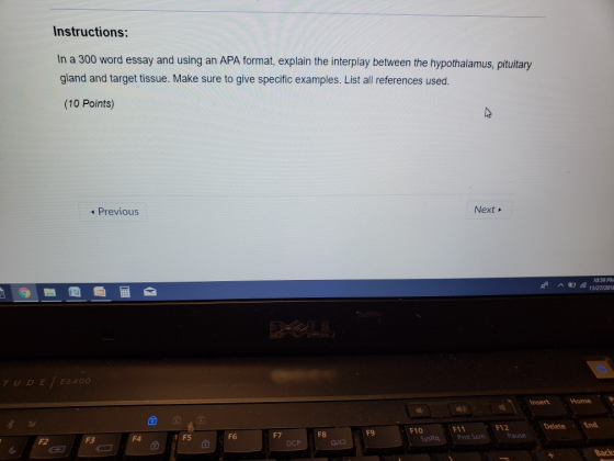 Instructions: In a 300 word essay and using an APA format, explain the interplay between the hypothalamus, pituitary gland and target tissue. Make sure to give specific examples. List all references used. (10 Points) Previous Next 10-59 P TUDE Insert Home F12 DeleteEnd F10 1 F5 F6 F7 F8 F9 SysRq Pause F2 F3 F4 DCP Back