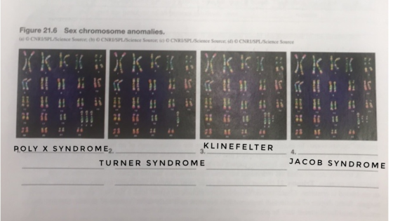 Figure 21.6 Sex chromosome anomalies. 6) OCNRISPL/Science Source () OCNRI/PL/Science Source ) OCNRI/SPEScience Source () OCNR