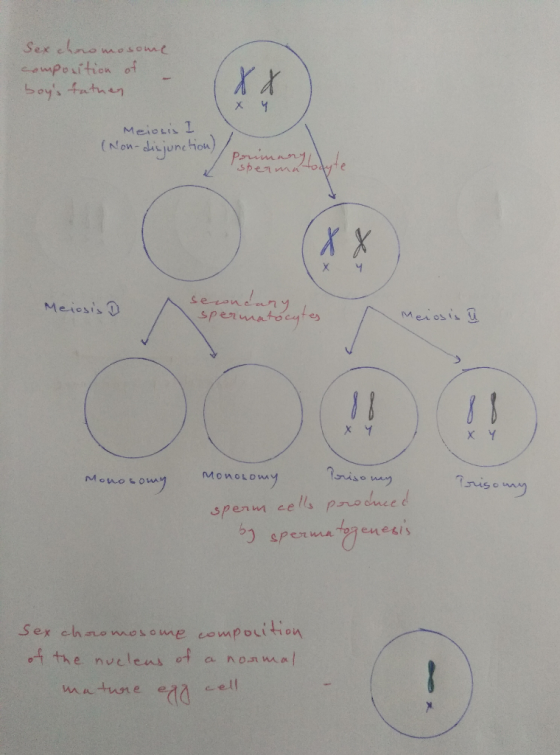 Sex chromosome composition of boys tathen x x х ч Meiosis I (Non-disjunction) Puma/ spermatodyte 88 secondary Meiosis 7 sper