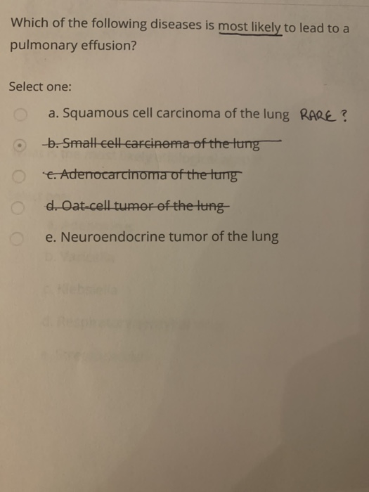 Which of the following diseases is most likely to lead to a pulmonary effusion? Select one: a. Squamous cell carcinoma of the