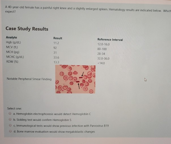 A 40-year-old female has a painful right knee and a slightly enlarged spleen. Hematology results are indicated below. Which e