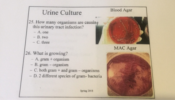Blood Agar Urine Culture 25, How many organisms are causing this urinary tract infection? A.0one - B. two - C. three MAC Agar