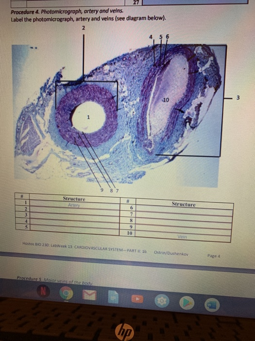Procedure 4. Photomicrograph, artery and veins. Label the photomicrograph, artery and velns (see diagram below). Structure HO