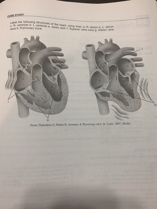 CASE STUDY be the following structures of the heart in B atrium b. L atrium B ventricle de ventricle e. Aortic arch 1, Superi