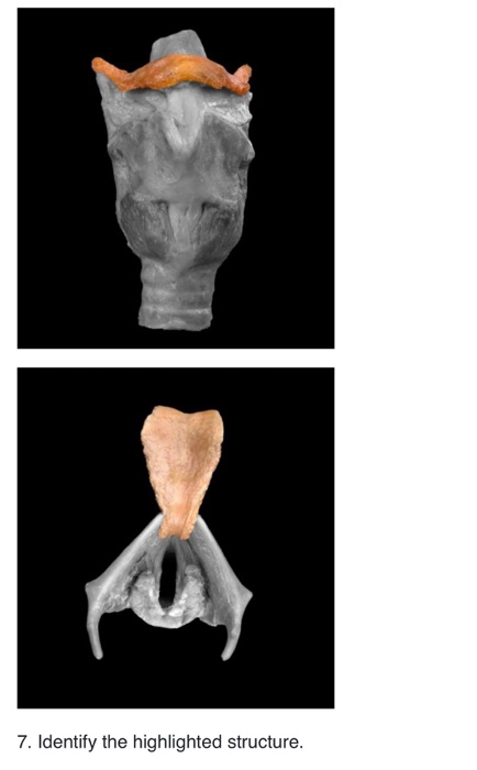 7. Identify the highlighted structure.