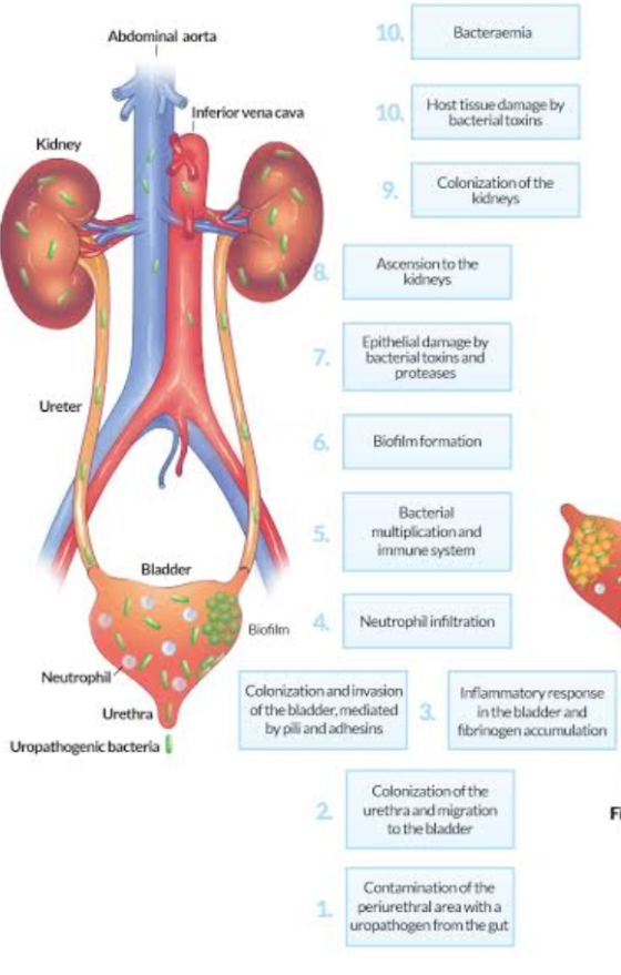 Abdominal aorta 10. Bacteraemia Inferior vena cava 10. Host tissue damage by bacterial toxins Kidney Colonization of the kidn