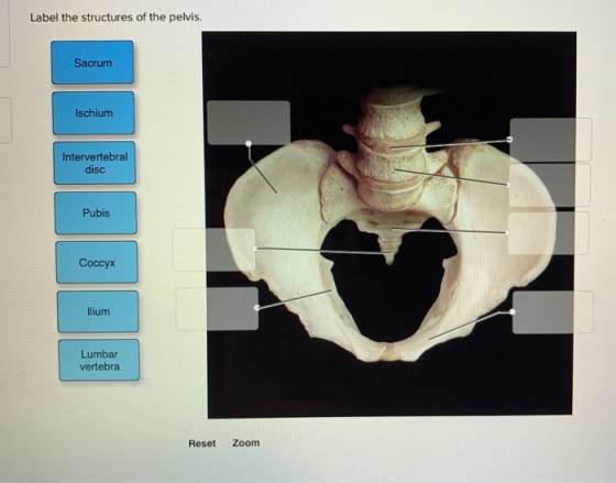 Label the structures of the pelvis. Sacrum Ischium Intervertebral disc Pubis Coccyx llium Lumbar vertebra Reset Zoom