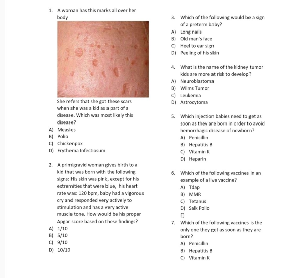 1. A woman has this marks all over her body 3. Which of the following would be a sign of a preterm baby? A) Long nails B) Old