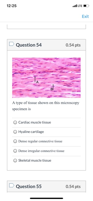 12:25 LTE ام Exit Question 54 0.54 pts A type of tissue shown on this microscopy specimen is Cardiac muscle tissue Hyaline ca