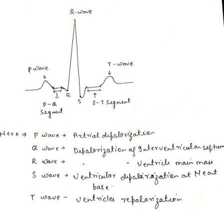 R-wowe T-Wave Pave p- a s s -T segment segment P wave wave R wave a I wave Artrial defalarization Depolarization of Intervent