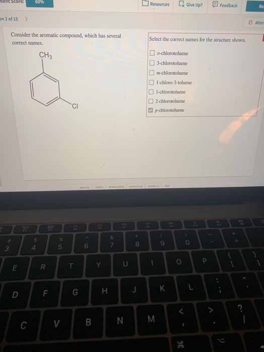 nent Score: 60% Resources Give Up? Feedback Re on 2 of 15 > Atter Select the correct names for the structure shown. Consider