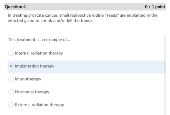 Question 4 0 / 1 point In treating prostate cancer, small radioactive lodine seeds are implanted in the infected gland to s