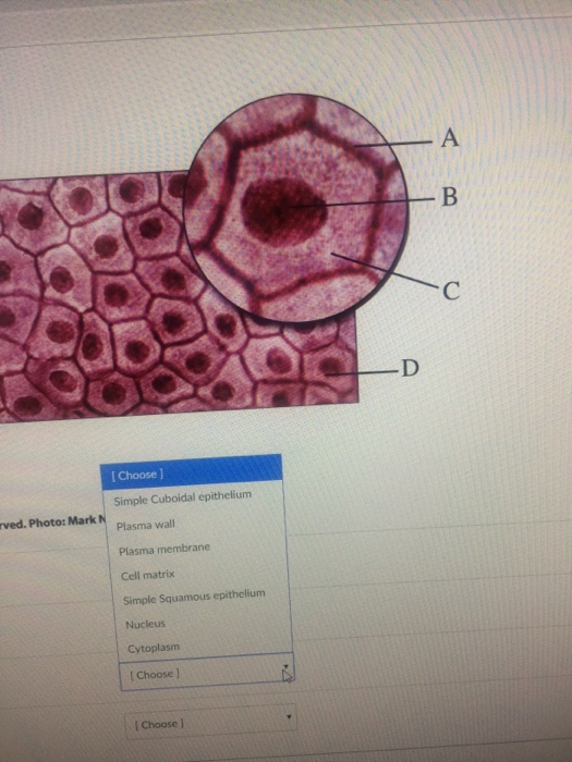 Choose ] Simple Cuboidal epithelium Plasma wall Plasma membrane Cell matrix Simple Squamous epithelium Nucleus Cytoplasm rved. Photo: Mark N Choose ] [Choose l