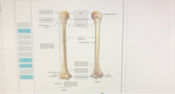 Greater bere He Greater tuberde Anatomica Intertubercules Surgica neck Detod tuberosity Radial groove Map con Coedve