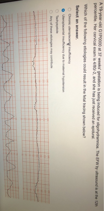 A 19-year-old G1P0000 at 37 weeks gestation is being induced for oligohydramnios. The EFW by ultrasound is at the 12th perce