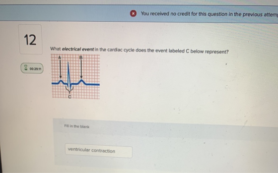 * You received no credit for this question in the previous attem 12 What electrical event in the cardiac cycle does the event