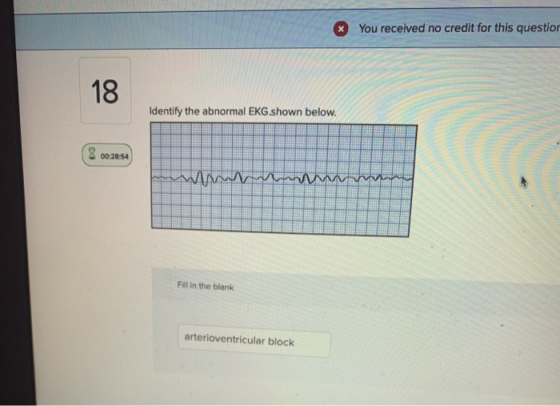* You received no credit for this question Identify the abnormal EKG shown below. 8 00:28:54 www Fill in the blank arterioven
