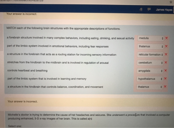 James Hayes Your answer is incorrect. MATCH each of the following brain structures with the appropriate descriptions of functions. a forebrain structure involved in many complex behaviors, including eating, drinking, and sexual activitymedulla part of the limbic system involved in emotional behaviors, including fear responses a structure in the forebrain that acts as a routing station for incoming sensory information stretches from the hindbrain to the midbrain and is involved in regulation of arousal controls heartbeat and breathing part of the limbic system that is involved in learning and memory a structure in the hindbrain that controls balance, coordination, and movement thalamus reticular formationX cerebellum amygdala hypothalamusX thalamus Your answer is incorrect. Michelles doctor is trying to determine the cause of her headaches and seizures. She underwent a procecure that involved a computer producing enhanced, 3-Dx-ray images of her brain. This is called a(n) Select one