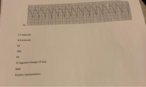 16. P-P Intervals R-R Intervals QT QRS ST Segment changes (if any) Rate Rhythm Interpretation: