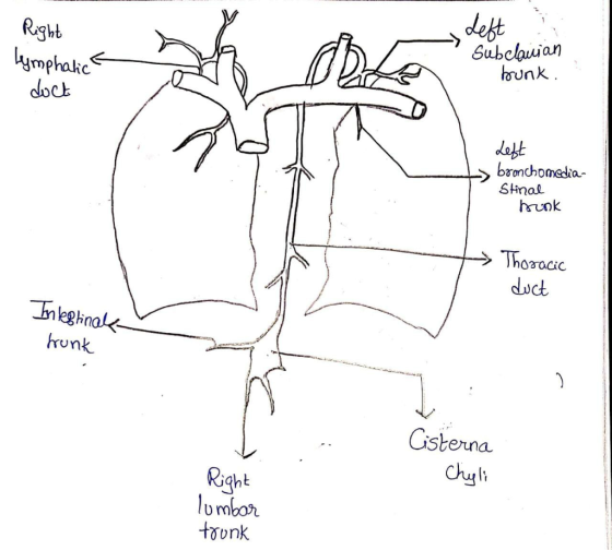 Right - Left Lymphatic doct Subclaujan bunk. Left bronchomedia Stinal Hunk I Thoracic duct Intestinal trunk ha Cisterna Chyli