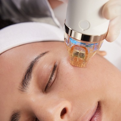 1773298884173784.jpg Best microneedling in Islamabad.jpg
