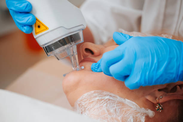 Can CO2 Laser Help with Rough Skin Texture.jpg